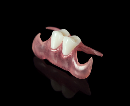 Valplast partial denture Unilateral